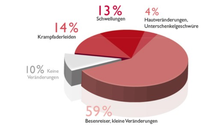 Grafik Venenschwäche Symptome Grafik Venenschwäche Symptome