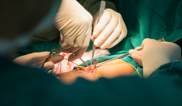 Venen-Operation Venen-Operation