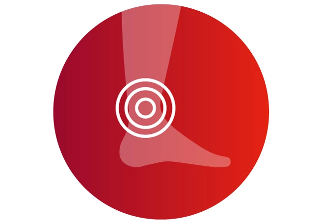 Venenschwäche Symptom Beinödeme